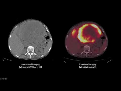 Nuclear Medicine Physics and Its Role in Modern Healthcare