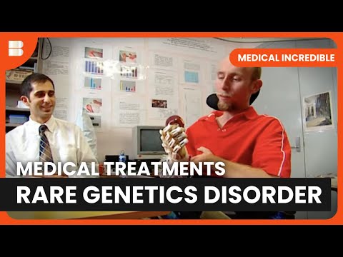 Unveiling the Rarest Genetic Conditions in Humans