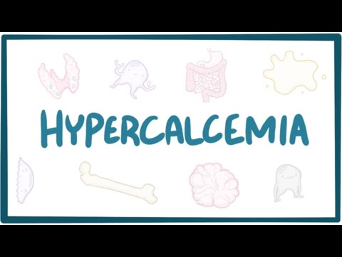 Mechanisms and Implications of Hypercalcemia Pathophysiology