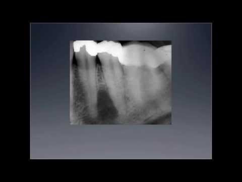 Periapical Pathology: Advances in Diagnosis and Treatment