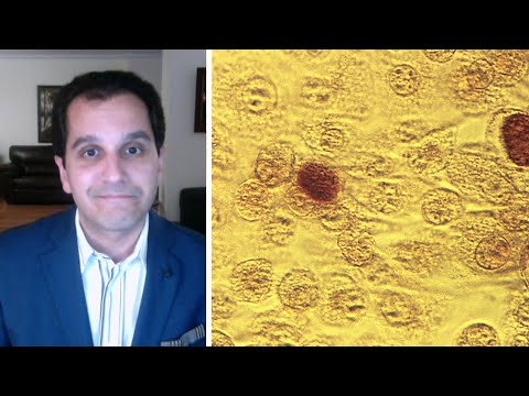 Epidemiologists Discuss Latest Trends and Challenges on Reddit