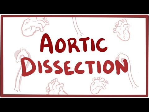 Insights into the Pathophysiology of Aortic Dissection
