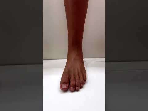 Innovations in Biomedical Prosthetics for Enhanced Mobility