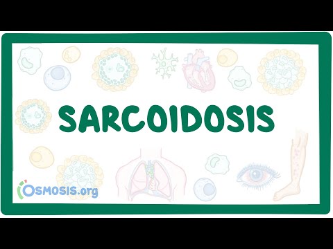 Advancements in Radiology for Sarcoidosis Diagnosis and Care