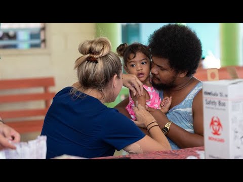 Measles Epidemiology and Its Global Health Implications