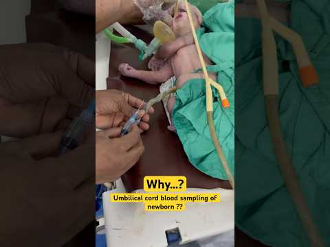 Advancements in Cord Blood Collection Techniques and Research
