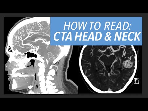 CT Neck Anatomy for Enhanced Medical Imaging Techniques