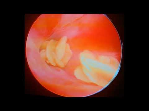 Bladder Anatomy in Dogs: Insights for Veterinary Science