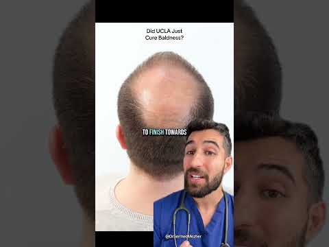 Advancements in Stem Cell Therapy for Local Hair Loss Solutions