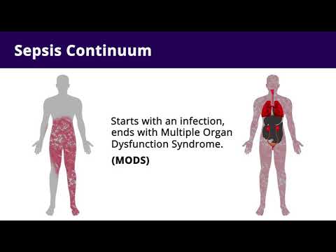Sepsis Pathophysiology: Implications for Nursing Practice