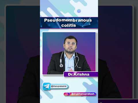 Radiological Insights into Pseudomembranous Colitis