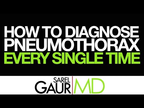 Advancements in Radiology for Diagnosing Pneumothorax