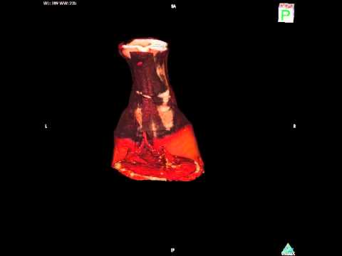 Goat Hoof Anatomy: Structure and Function in Science