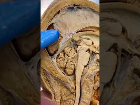 TM Anatomy in Focus: Bridging Science and Outreach