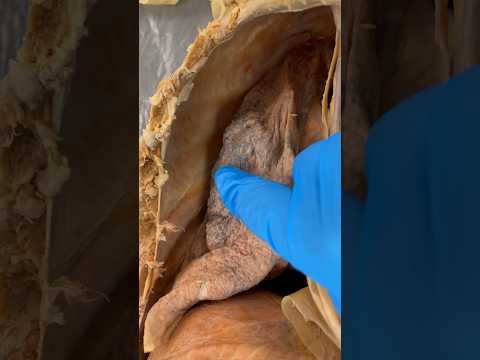 Anatomical Left and Right: Significance in Biological Sciences