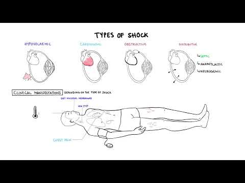 Distributive Shock Pathophysiology: Mechanisms and Implications