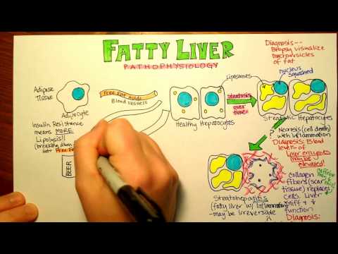 Liver Pathophysiology: Mechanisms and Implications in Health