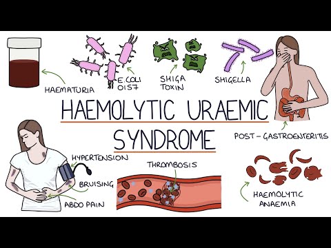 Hus Pathophysiology Insights for Scientific Outreach
