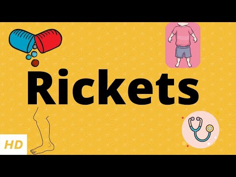 Rickets Pathophysiology: Mechanisms and Implications in Health