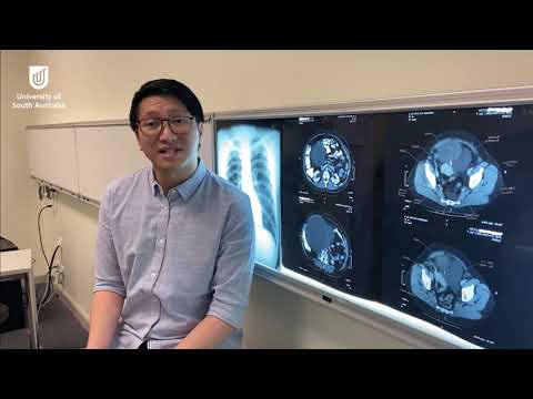 Radiation Levels in Chest X-Rays: Safety and Science