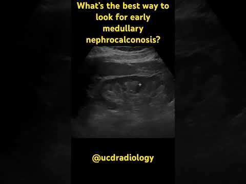 Nephrocalcinosis in Radiology: Imaging Techniques and Findings