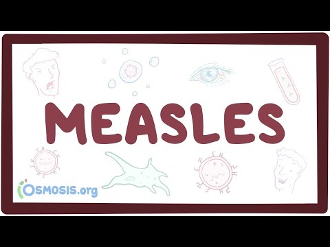 Measles Pathophysiology and Its Implications for Public Health