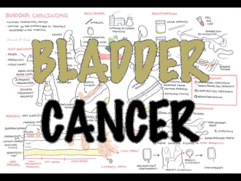 Pathophysiology of Bladder Cancer: Mechanisms and Implications